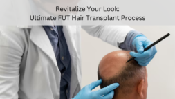 FUT hair transplant process